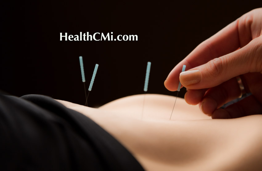 Acupuncture Adenomyosis Relief Found