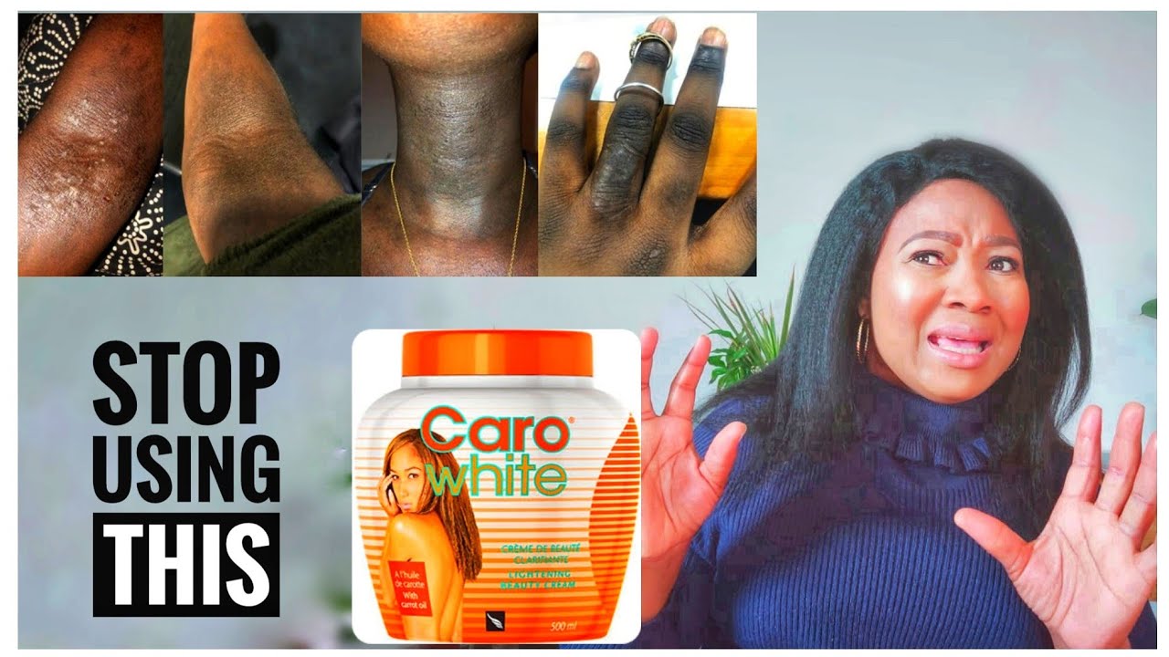 What Happens When You Stop Using Caro White?