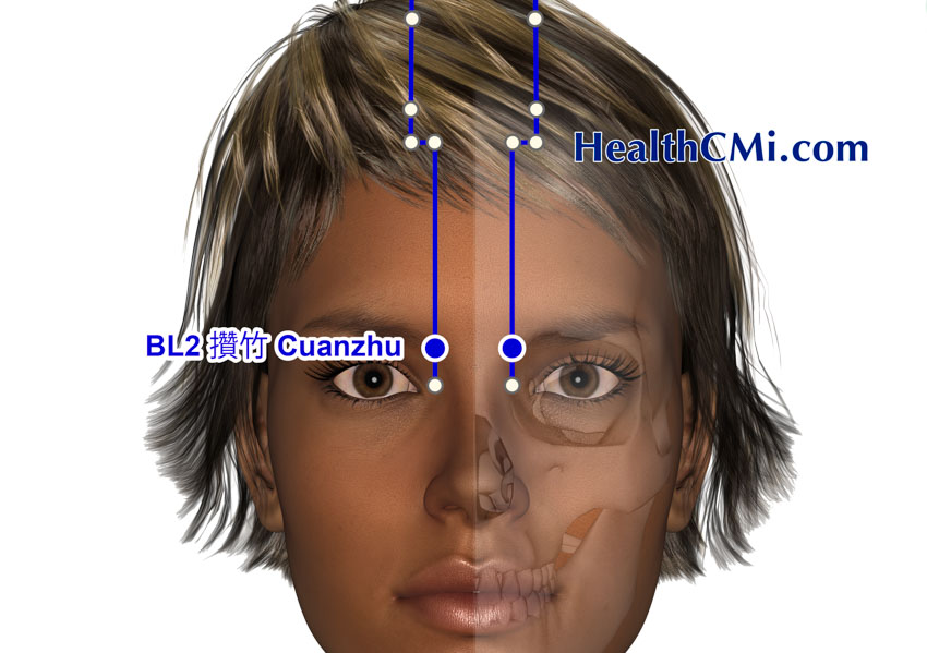 Acupuncture Alleviates Bell’s Palsy Finding