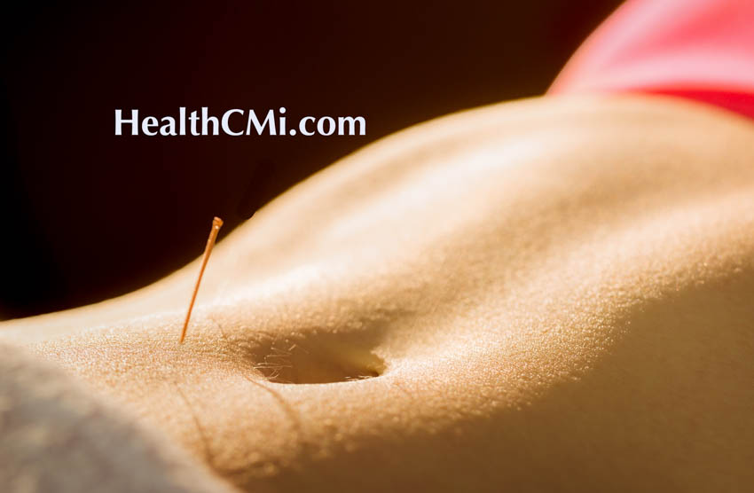 Acupuncture Alleviates Uterine Adhesions