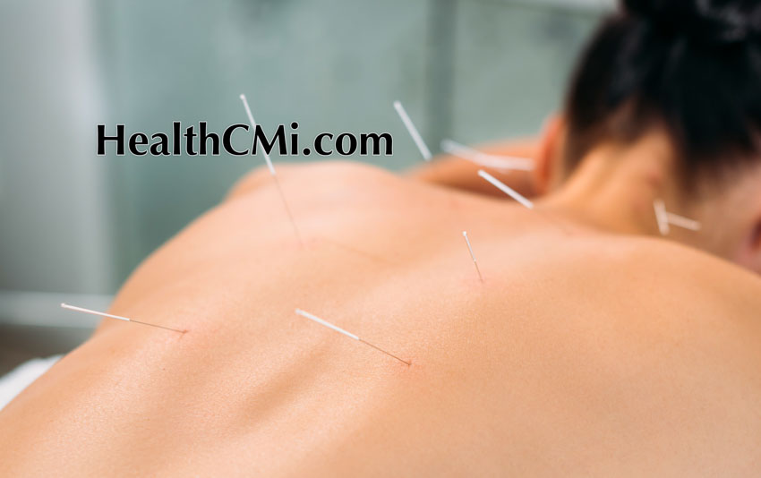 Acupuncture Chronic Heart Failure Success Reported