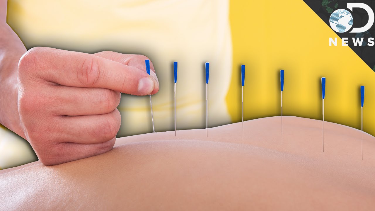 Does Acupuncture Even Work?