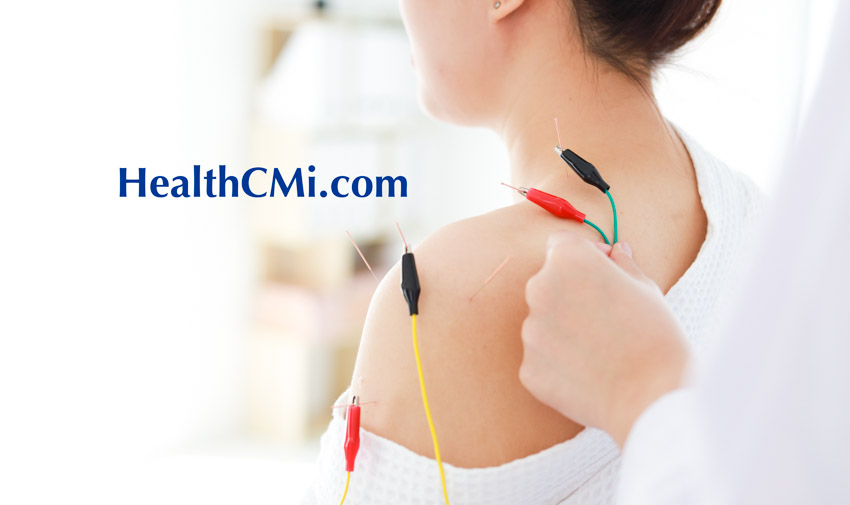 Florida and Fuzhou Discovery: Acupuncture Reduces Pain