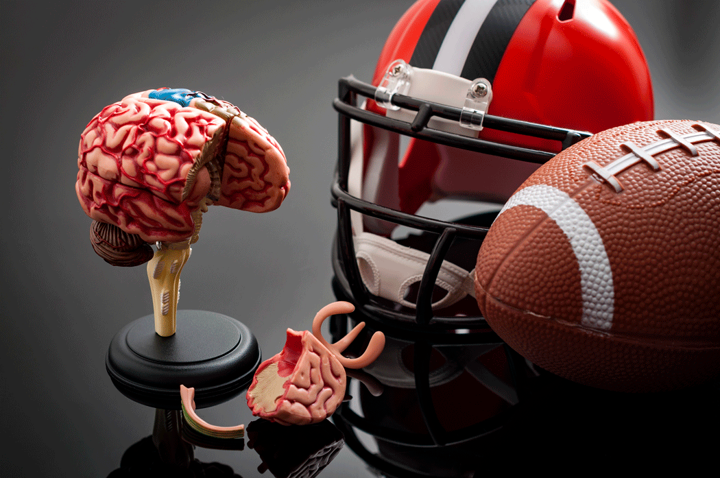 How sports-related concussions affect mental health