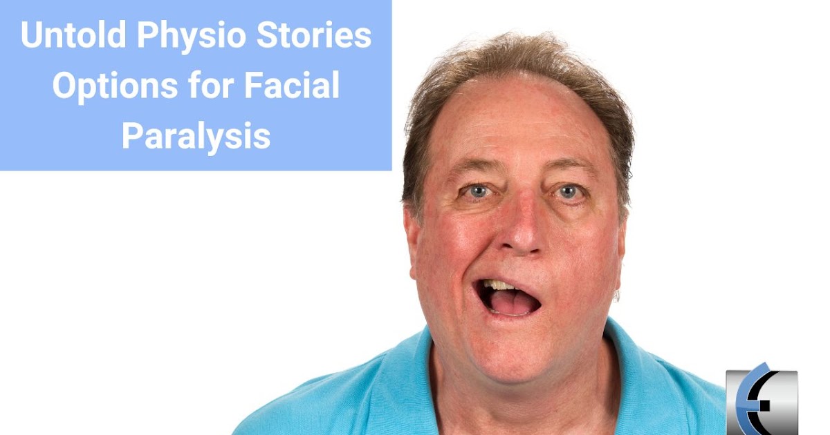 Untold Physio Stories – Options for Facial Paralysis | Modern Manual Therapy Blog