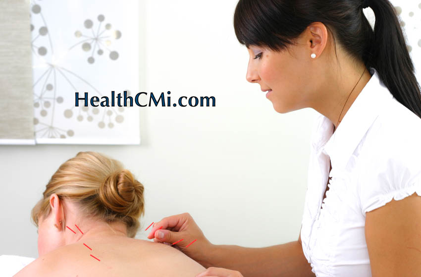 Acupuncture Found Effective For Chemotherapy Side Effect Relief