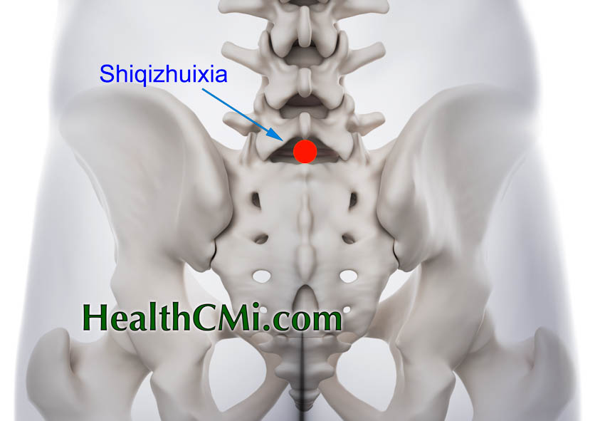 Acupuncture Lumbar Disc Herniation Pain Relief Achieved