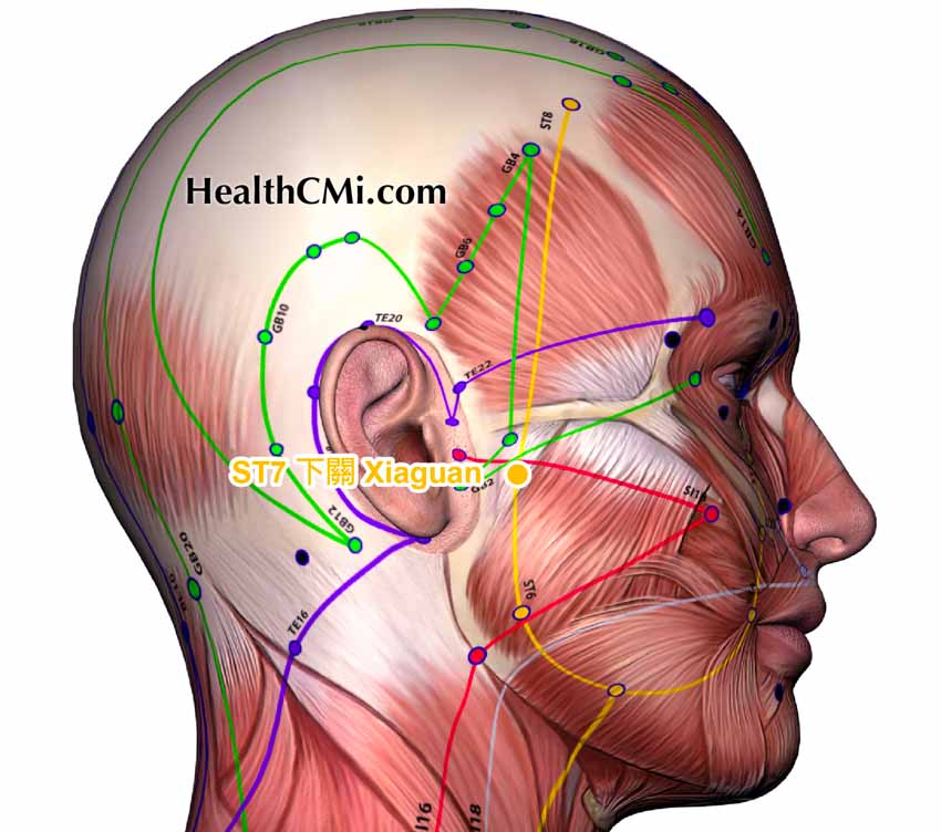 Acupuncture Provides Trigeminal Neuralgia Relief