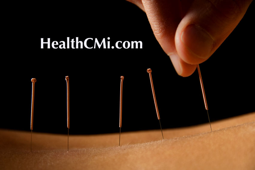 Acupuncture Spinal Cord Rehabilitation Findings