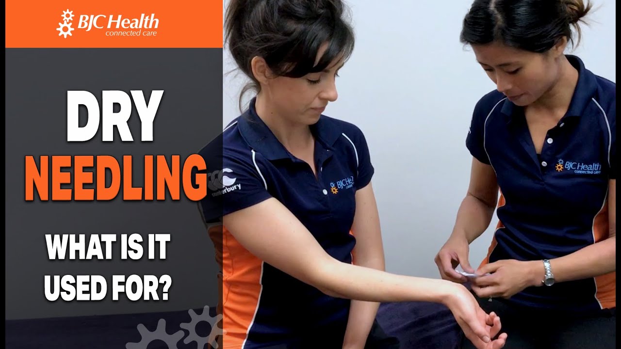 Dry needling- how does it differ from acupuncture? What is it used for?