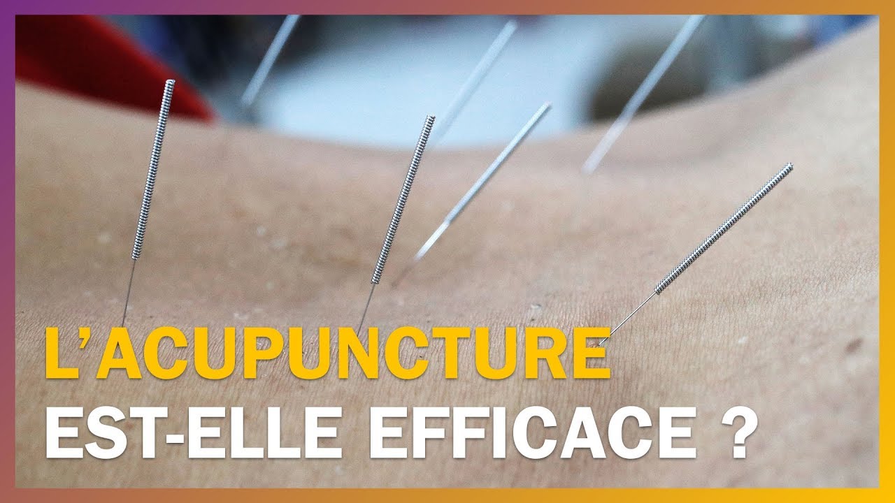 L'acupuncture est-elle efficace ?