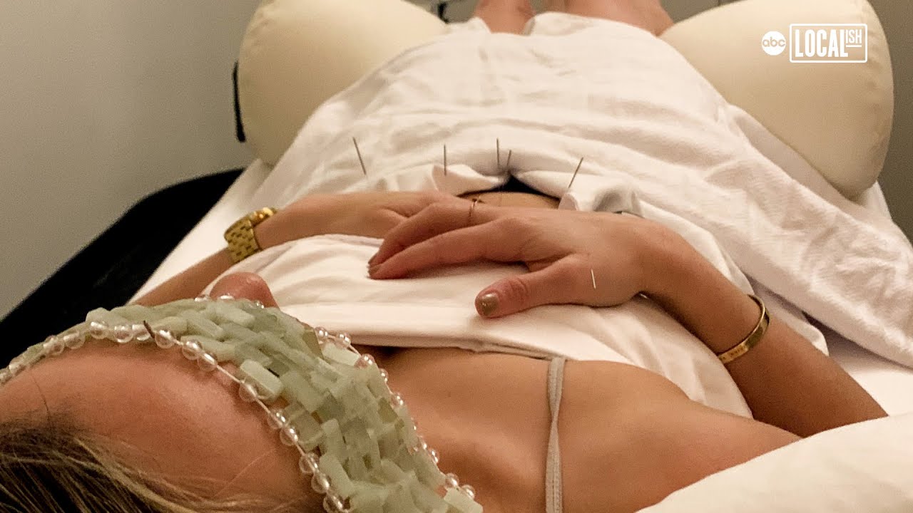 We tried acupuncture to relieve pain & stress. Here's what happened