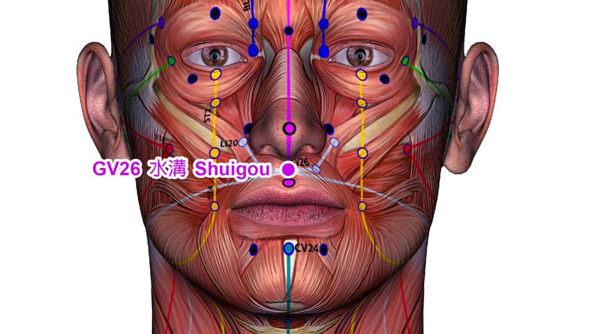 Acupuncture Found Effective For Post-Stroke Hemiplegia​​