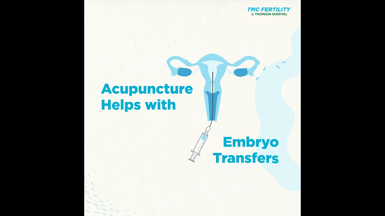 IVF & Acupuncture: Why it Works