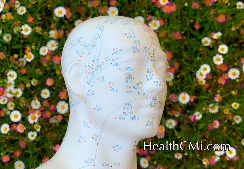 Acupuncture Provides Tinnitus Relief Finding