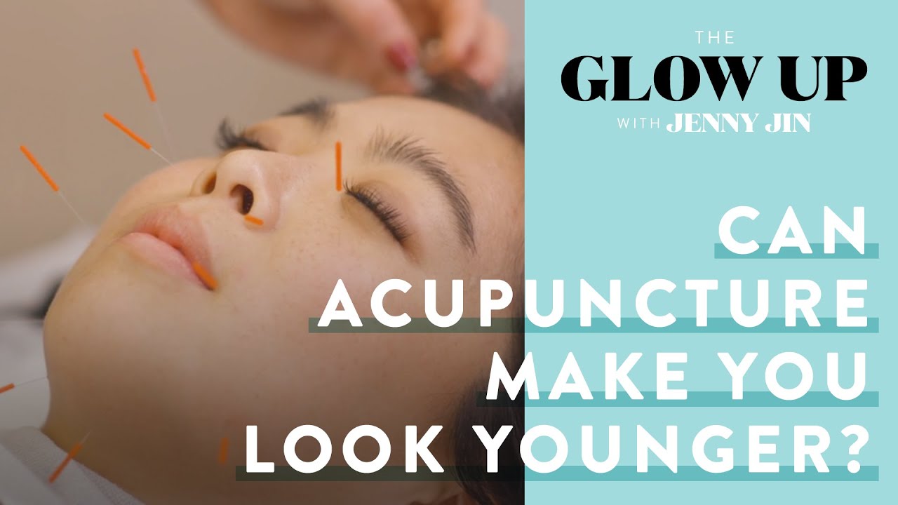 Can Facial Acupuncture Make You Look Younger? | The Glow Up