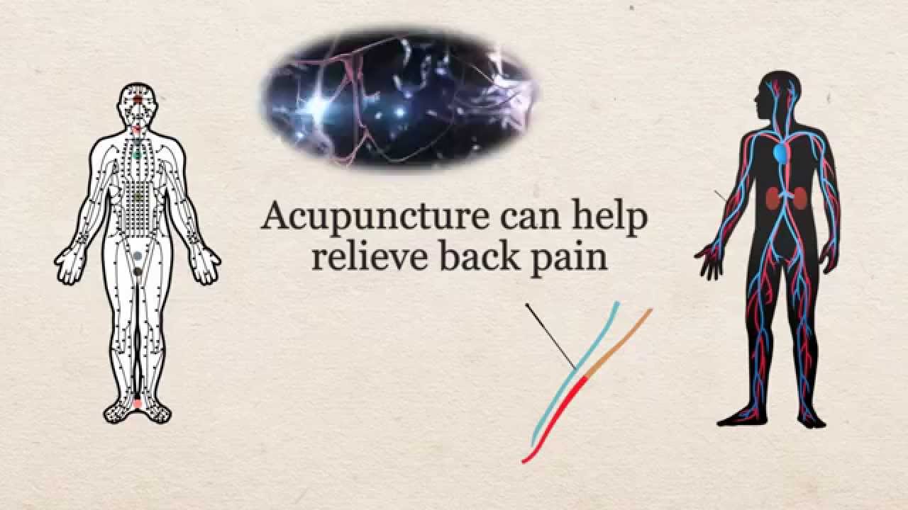 What is acupuncture?