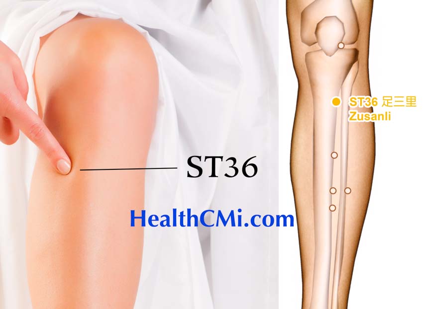 Acupuncture Provides Post Stroke Lower Limb Improvements