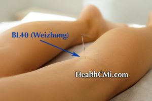 Acupuncture Post-Op Lumbar Disk Herniation Relief