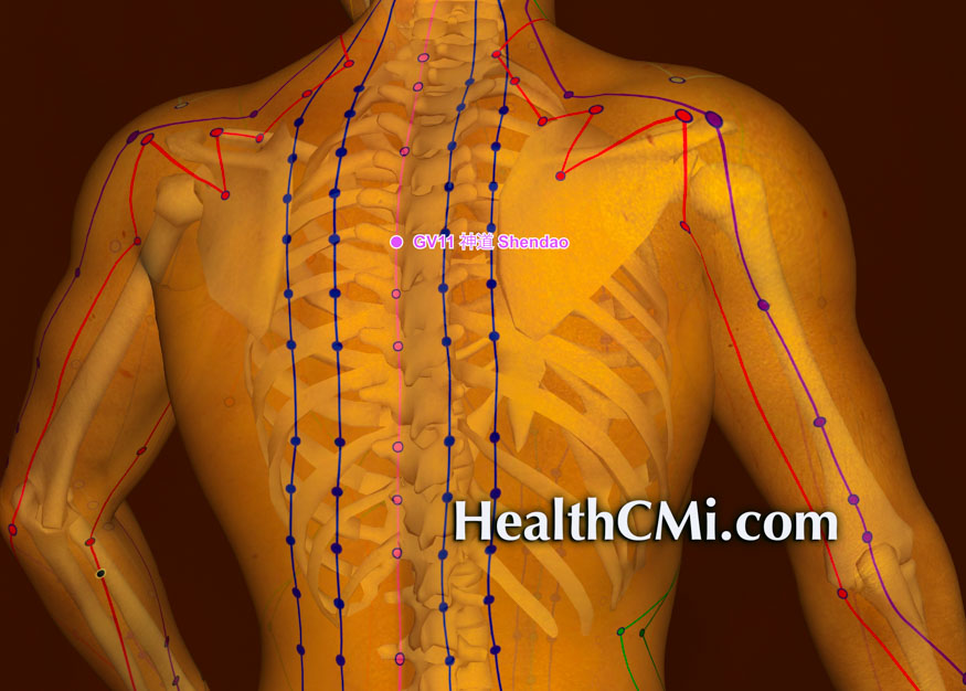 Acupuncture Alleviates Hives