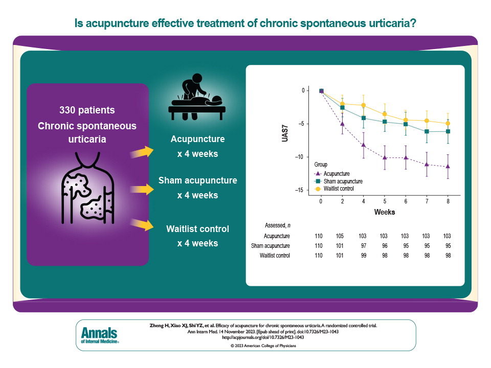 Acupuncture for CSU – The BMAS Blog