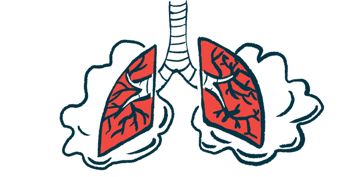 Pulmonary rehabilitation reduces exacerbations, risk of death