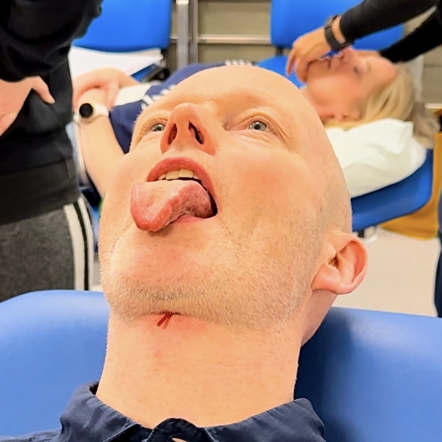 Acupuncture for swallowing in PSD 2024 – The BMAS Blog