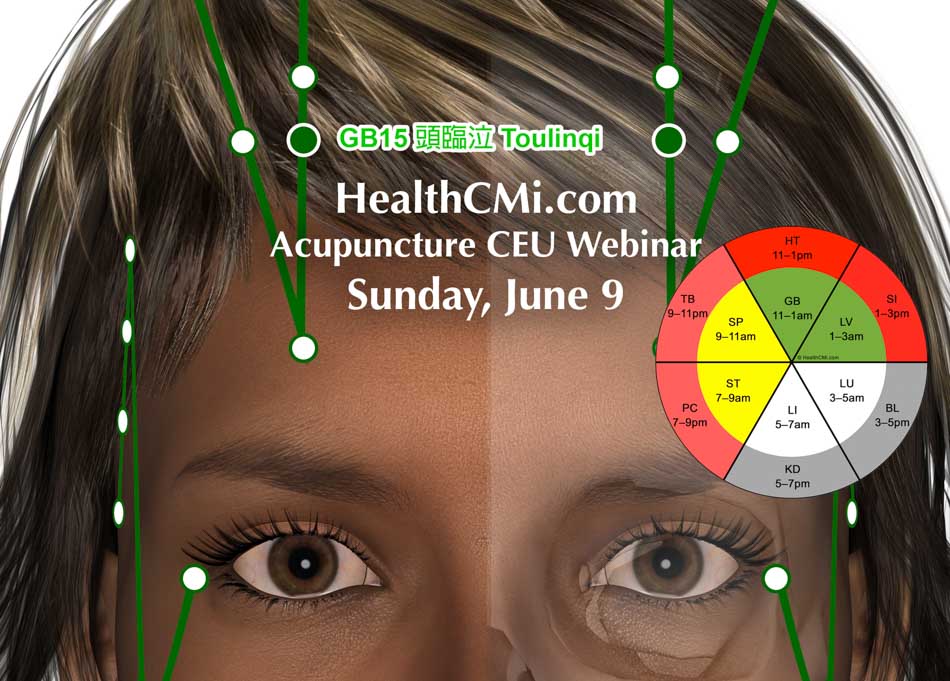 Acupuncture Event For Better Sleep And Relaxation