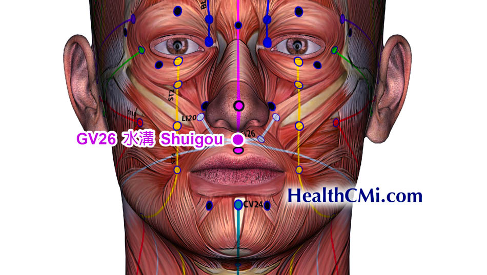 Acupuncture Found Effective in Treating Stroke