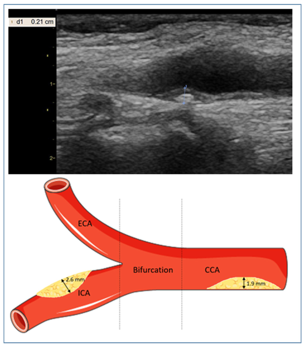 Acupuncture for CAD 2024 – The BMAS Blog