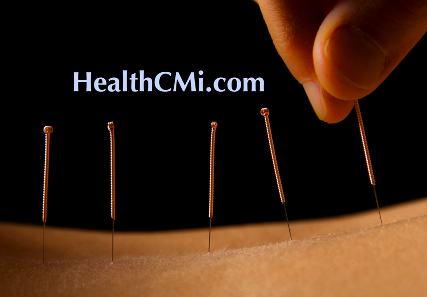 Florida Board of Acupuncture Changes