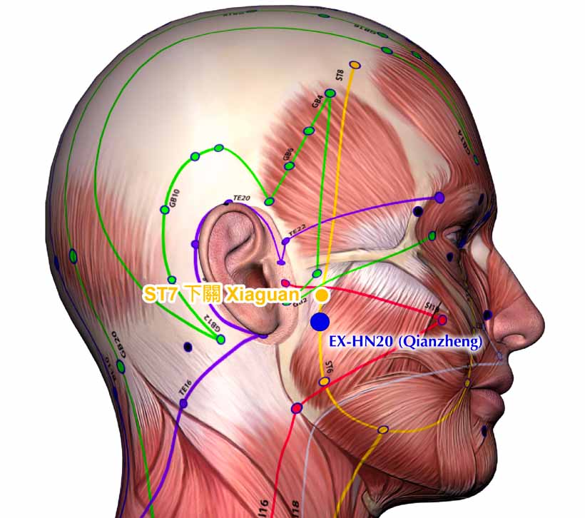 Acupuncture Facial Paralysis Rapid Intervention Success