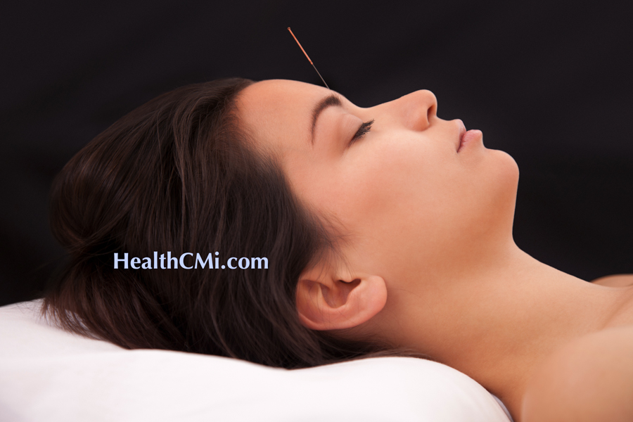 Acupuncture Sinus Allergy Relief Test Successful