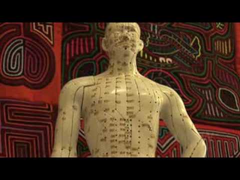 Acupuncture for Depression