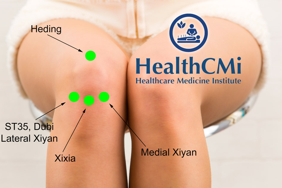 Acupuncture for Knee Osteoarthritis Results