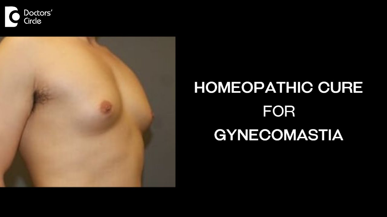 Can Homeopathy cure Gynecomastia? | Hormonal Imbalance – Dr. Surekha Tiwari | Doctors' Circle