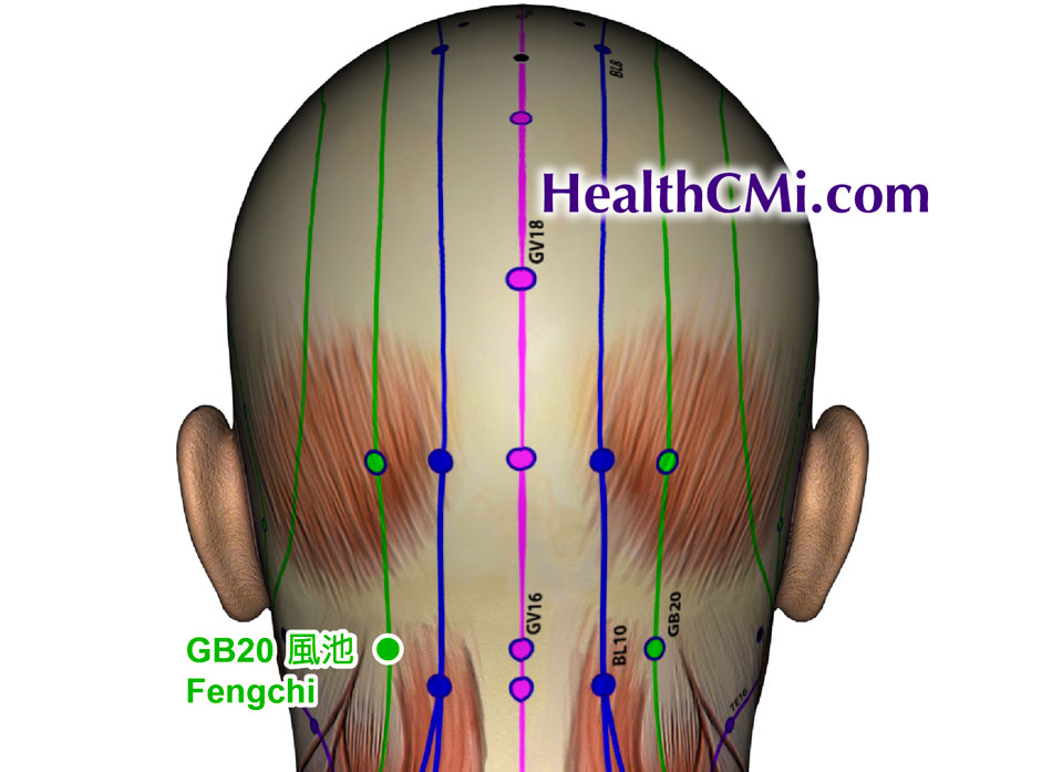 Acupuncture Reduces Stroke Risk For Arthritis Patients