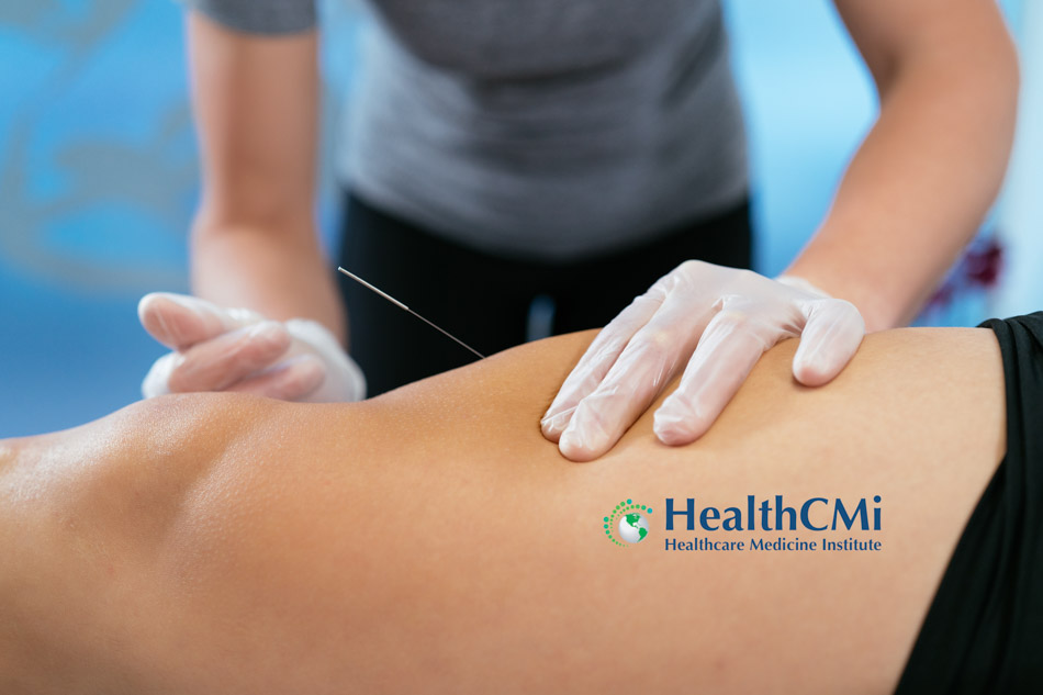 Acupuncture for Knee Arthritis Proven Effective